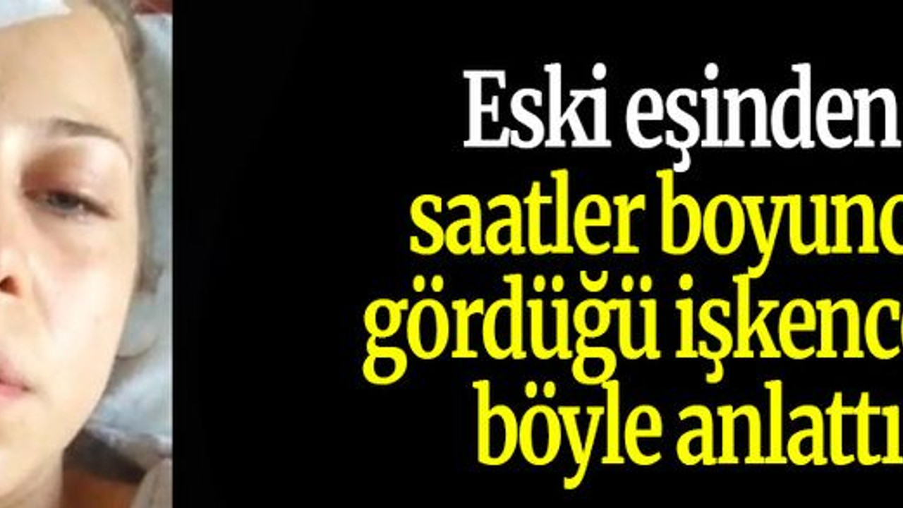 Eski eşinden saatler boyunca gördüğü işkenceyi böyle anlattı